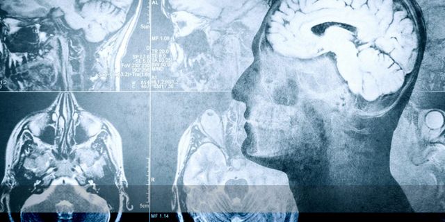 Ölen bir insanın beyin aktiviteleri ilk kez görüntülendi