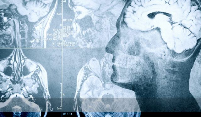 Ölen bir insanın beyin aktiviteleri ilk kez görüntülendi